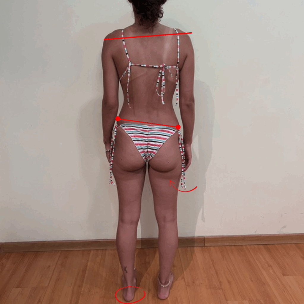 Avaliação postural