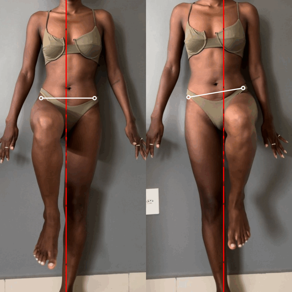 Quadril direito fraco